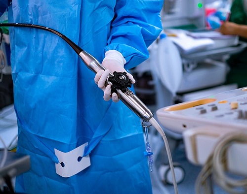 Transoesophageal Echocardiography